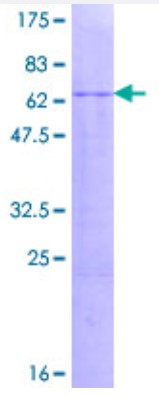 SDS-PAGE (NR2E1-6081H).jpg